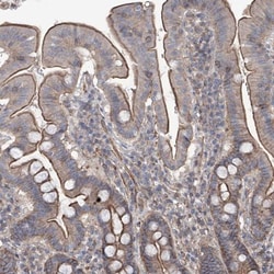 anti-PIEZO2, Polyclonal, Novus Biologicals 0.1mL; Unlabeled:Antibodies,