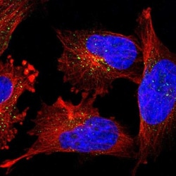 PIG3 Antibody, Novus Biologicals:Antibodies:Primary Antibodies