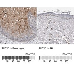 PIG3 Antibody, Novus Biologicals 25 &mu;L | Buy Online | Novus Biologicals | Fisher Scientific