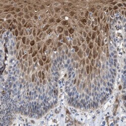 PIG3 Antibody, Novus Biologicals:Antibodies:Primary Antibodies