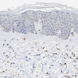 PIG3 Antibody, Novus Biologicals:Antibodies:Primary Antibodies