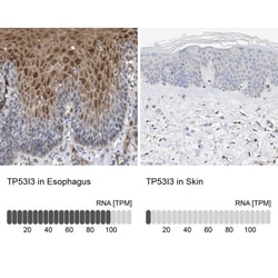 PIG3 Antibody, Novus Biologicals:Antibodies:Primary Antibodies