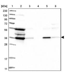 PIG3 Antibody, Novus Biologicals 25 &mu;L | Buy Online | Novus Biologicals | Fisher Scientific