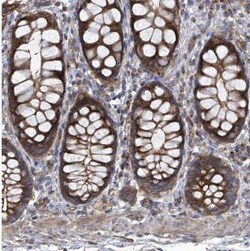 PIGH Antibody, Novus Biologicals 0.1mL; Unlabeled:Antibodies, Polyclonal