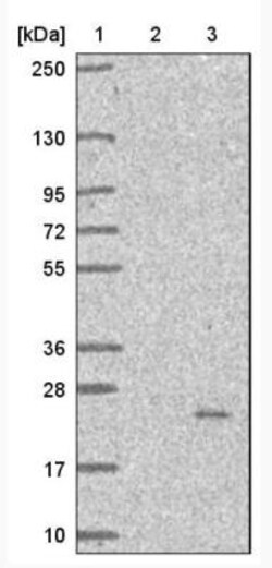 PIGH Antibody, Novus Biologicals 0.1mL; Unlabeled:Antibodies, Polyclonal