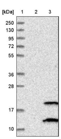 PIGP Antibody, Novus Biologicals:Antibodies:Primary Antibodies