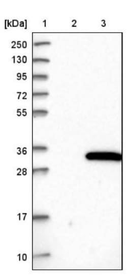 PIGX Antibody, Novus Biologicals 0.1mL; Unlabeled:Antibodies, Polyclonal