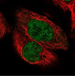 PIK3C2A Antibody, Novus Biologicals 0.1mL; Unlabeled:Antibodies, Polyclonal