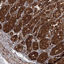 PIK3C2A Antibody, Novus Biologicals:Antibodies:Primary Antibodies