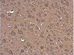 PIK3R5 Antibody, Novus Biologicals 0.1mL; Unlabeled:Antibodies, Polyclonal