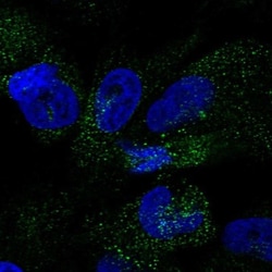 PINLYP Antibody, Novus Biologicals:Antibodies:Primary Antibodies