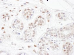 PINX1 Antibody, Novus Biologicals 0.1mg; Unlabeled:Antibodies, Polyclonal