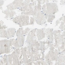 PIP Antibody, Novus Biologicals 0.1mL; Unlabeled:Antibodies, Polyclonal