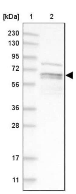PIP5K1 alpha Antibody, Novus Biologicals 0.1mL; Unlabeled:Antibodies, Polyclonal