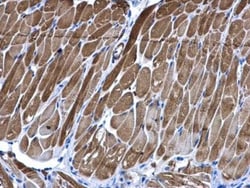 PIP5K2B Antibody, Novus Biologicals 0.1mL; Unlabeled:Antibodies, Polyclonal