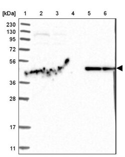 PISD Antibody, Novus Biologicals 25 &mu;L | Buy Online | Novus Biologicals | Fisher Scientific