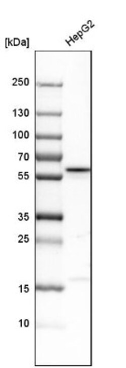 PIST Antibody, Novus Biologicals 0.1mL; Unlabeled:Antibodies, Polyclonal