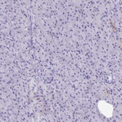 PITPNM3 Antibody, Novus Biologicals 25 &mu;L, Unlabeled:Antibodies, Polyclonal