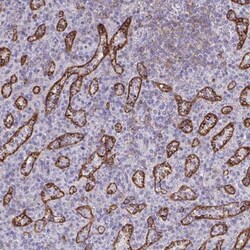 PITPNM3 Antibody, Novus Biologicals 0.1mL; Unlabeled:Antibodies, Polyclonal