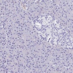 PITPNM3 Antibody, Novus Biologicals 0.1mL; Unlabeled:Antibodies, Polyclonal
