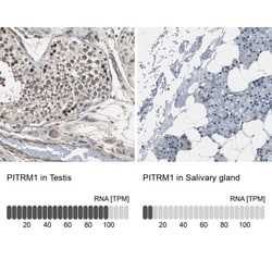 PITRM1 Antibody, Novus Biologicals 0.1mL; Unlabeled:Antibodies, Polyclonal