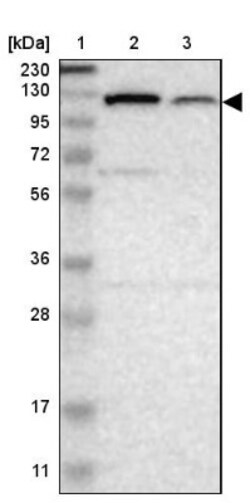 PITRM1 Antibody, Novus Biologicals 0.1mL; Unlabeled:Antibodies, Polyclonal