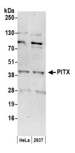 PITX1 Antibody, Novus Biologicals 100 &mu;L | Buy Online | Novus Biologicals | Fisher Scientific