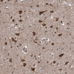 PJA2/Praja2 Antibody, Novus Biologicals 0.1mL; Unlabeled:Antibodies, Polyclonal