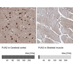 PJA2/Praja2 Antibody, Novus Biologicals 0.1mL; Unlabeled:Antibodies, Polyclonal