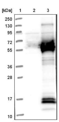 PKA RI beta Antibody, Novus Biologicals:Antibodies:Primary Antibodies