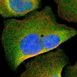 PKC alpha Antibody, Novus Biologicals 25 &mu;L; Unlabeled:Antibodies, Polyclonal