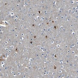 PKC alpha Antibody, Novus Biologicals 25 &mu;L; Unlabeled:Antibodies, Polyclonal