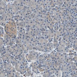 PKC alpha Antibody, Novus Biologicals 25 &mu;L; Unlabeled:Antibodies, Polyclonal