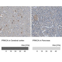 PKC alpha Antibody, Novus Biologicals 25 &mu;L; Unlabeled:Antibodies, Polyclonal