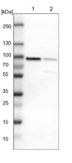 PKC alpha Antibody, Novus Biologicals 25 &mu;L; Unlabeled:Antibodies, Polyclonal