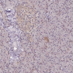 PKC beta Antibody, Novus Biologicals:Anticuerpos:Anticuerpos primarios