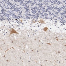 PKC delta Antibody, Novus Biologicals:Antibodies:Primary Antibodies