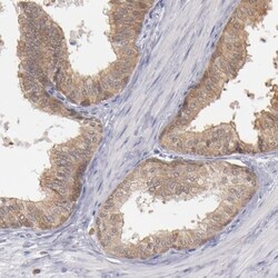 PKC delta Antibody, Novus Biologicals:Antibodies:Primary Antibodies