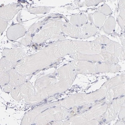 PKC delta Antibody, Novus Biologicals:Antibodies:Primary Antibodies