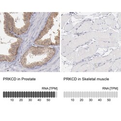 PKC delta Antibody, Novus Biologicals:Antibodies:Primary Antibodies