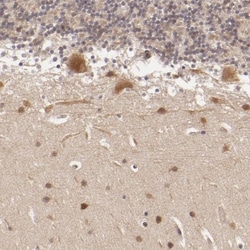 PKC delta Antibody, Novus Biologicals 0.1mL; Unlabeled:Antibodies, Polyclonal