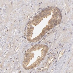 PKC delta Antibody, Novus Biologicals 0.1mL; Unlabeled:Antibodies, Polyclonal
