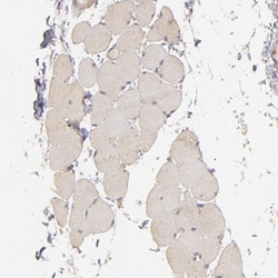 PKC delta Antibody, Novus Biologicals 0.1mL; Unlabeled:Antibodies, Polyclonal