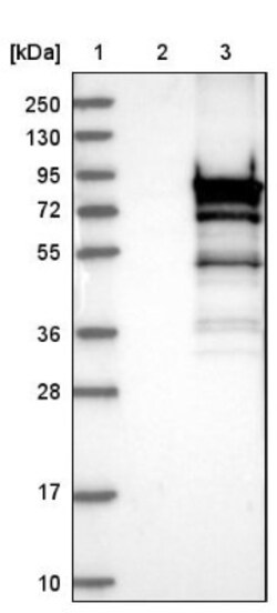 PKC delta Antibody, Novus Biologicals:Antibodies:Primary Antibodies