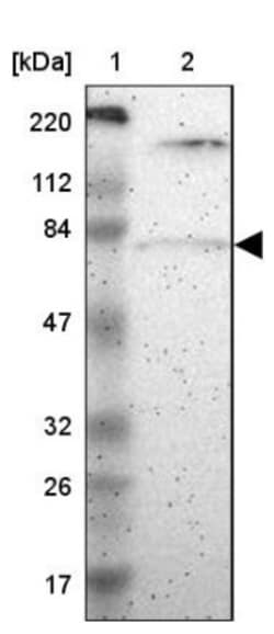 PKC delta Antibody, Novus Biologicals 0.1mL; Unlabeled:Antibodies, Polyclonal