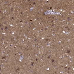 PKC epsilon Antibody, Novus Biologicals 0.1mL; Unlabeled:Antibodies, Polyclonal