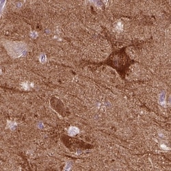 PKC epsilon Antibody, Novus Biologicals 0.1mL; Unlabeled:Antibodies, Polyclonal