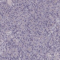 PKC epsilon Antibody, Novus Biologicals 0.1mL; Unlabeled:Antibodies, Polyclonal
