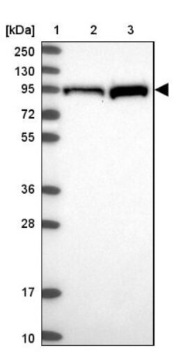 PKC epsilon Antibody, Novus Biologicals 0.1mL; Unlabeled:Antibodies, Polyclonal