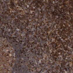PKC eta Antibody, Novus Biologicals 0.1mL; Unlabeled:Antibodies